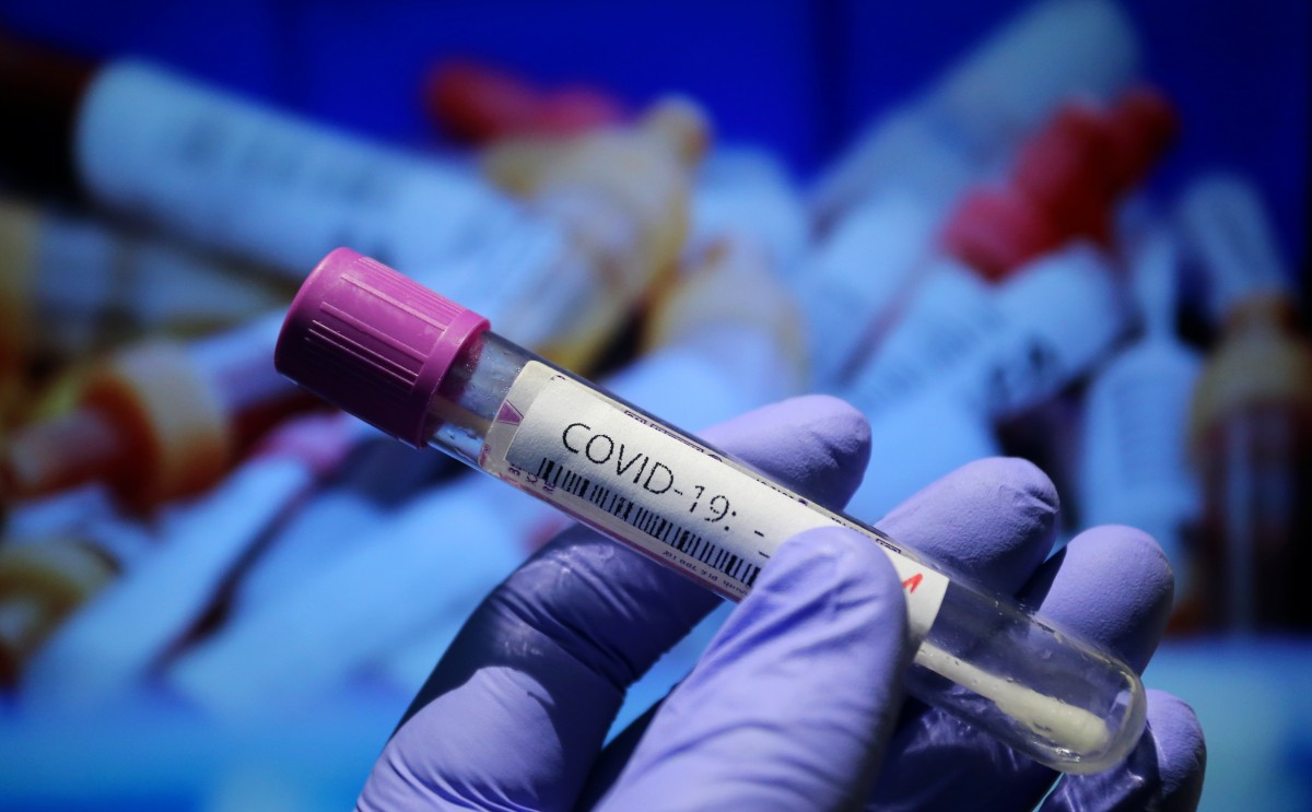 Китай регистрира нов рекорд на заразени с коронавирус