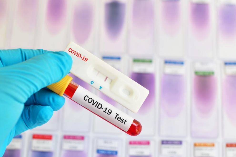 41 са новите случаи на коронавирус